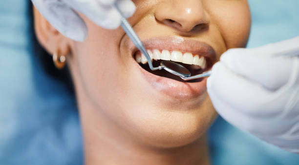 Best Dental Abscess Treatment in Denver, IA