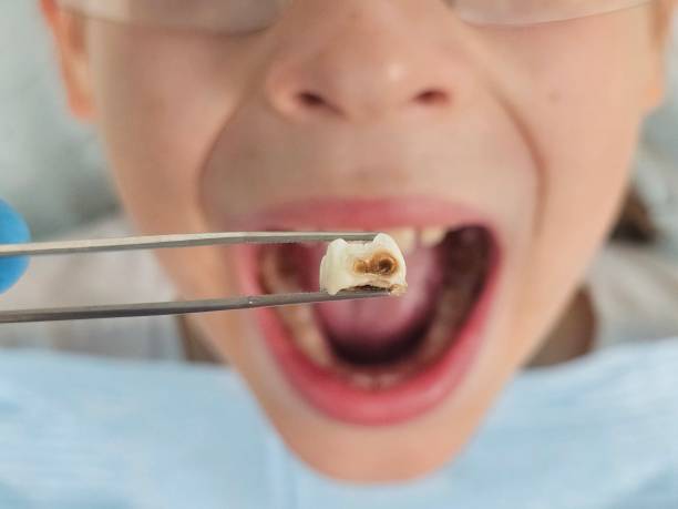 Best Emergency Pediatric Dental Care in Denver, IA
